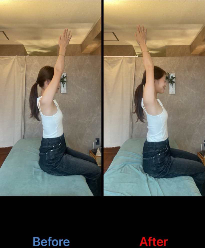 肩甲骨剥がし,整体