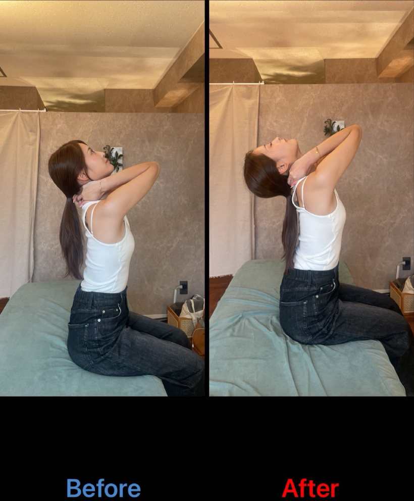 肩甲骨剥がし,整体